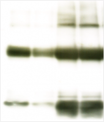 018-22401, 015-22411 Anti Ago 1 – Investigación del microARN
