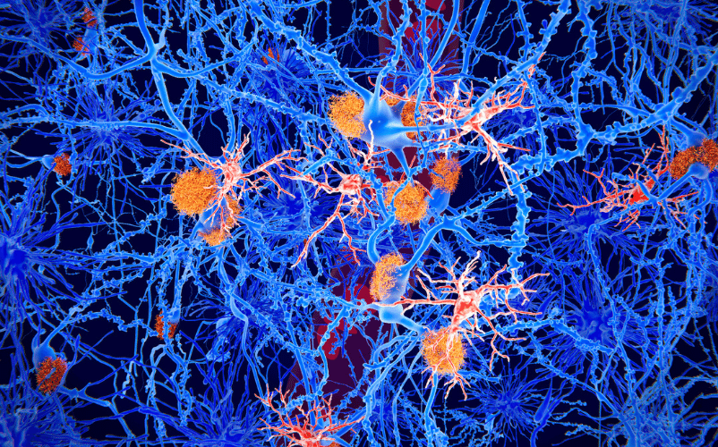 Segunda revisión: Origen de las microglías y las Enfermedades Cerebrales | FUJIFILM Wako