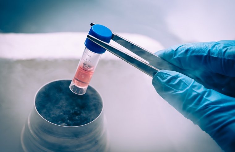 4 reactivos de uso en laboratorios de cultivos celulares