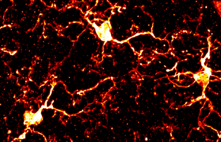 Primera Revisión: Dolor Neuropático