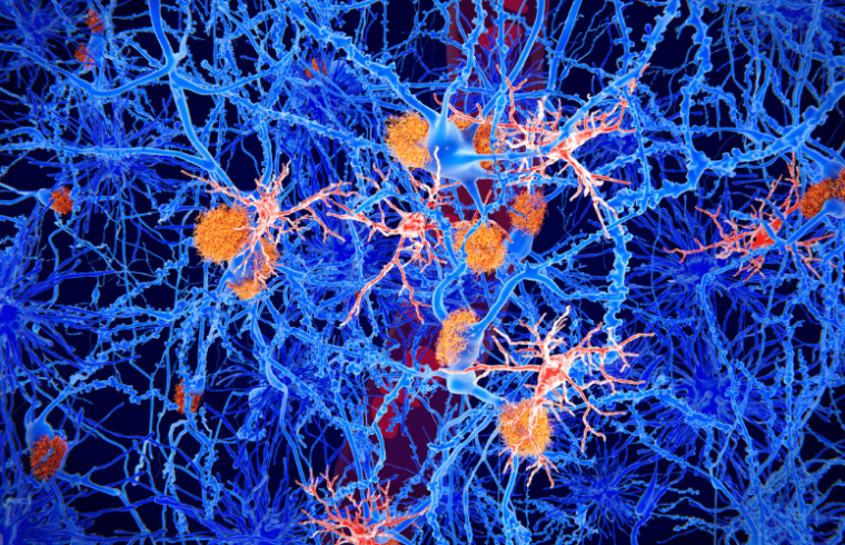 Segunda revisión: Origen de las Microglías y las Enfermedades Cerebrales