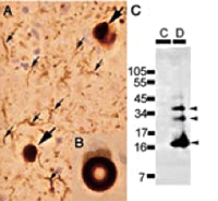 Anti-α-Sinucleína fosforilada